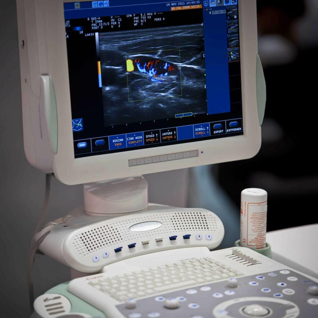 schermo con immagini tomografiche vene