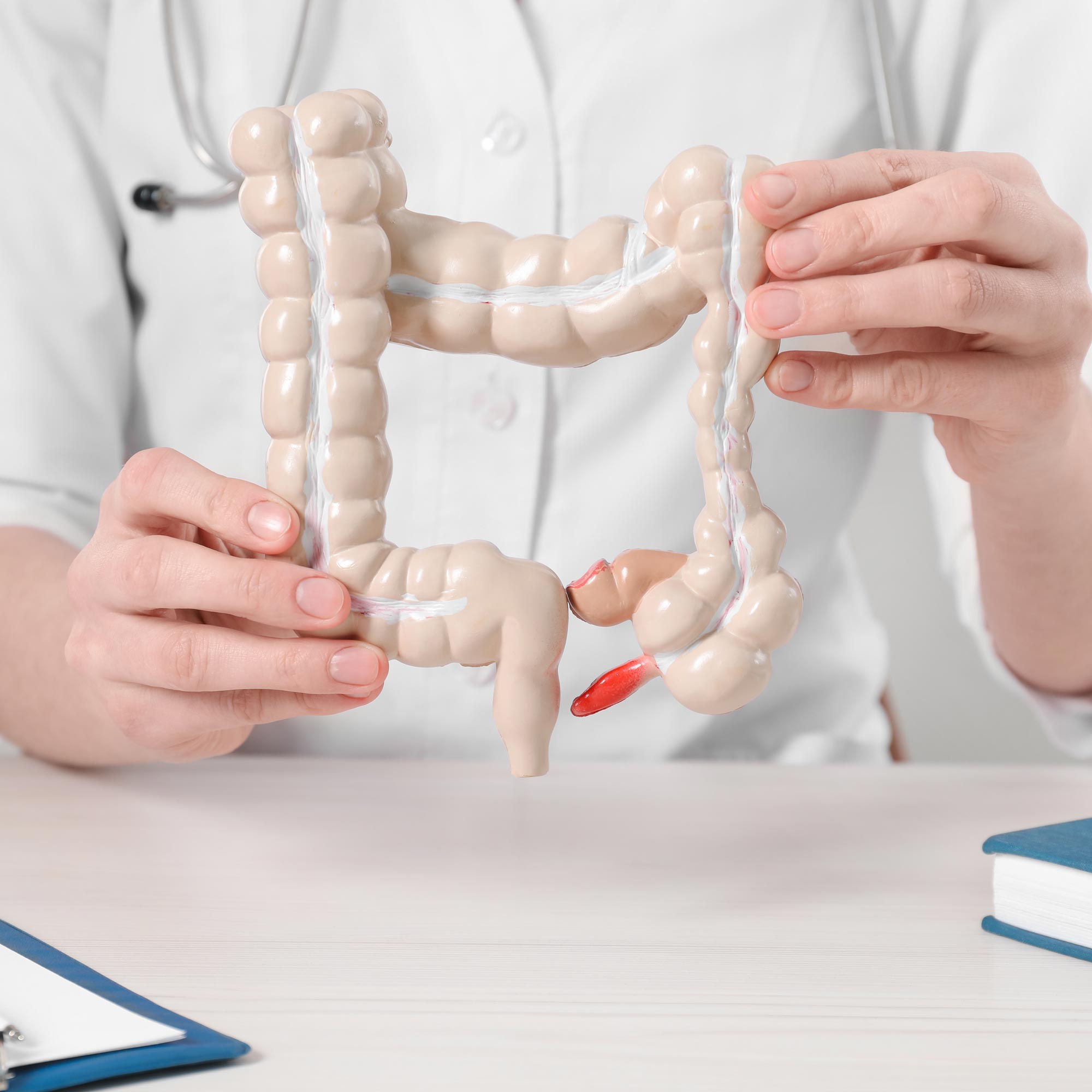 medico tiene in mano un modellino dell'intestino utile per confrontarsi con i pazienti