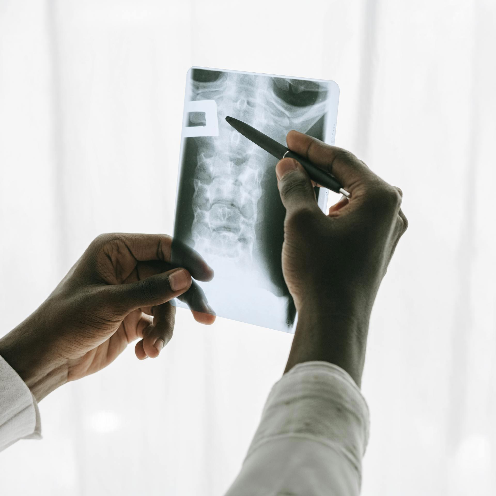 medico discute il risultato di una radiografia