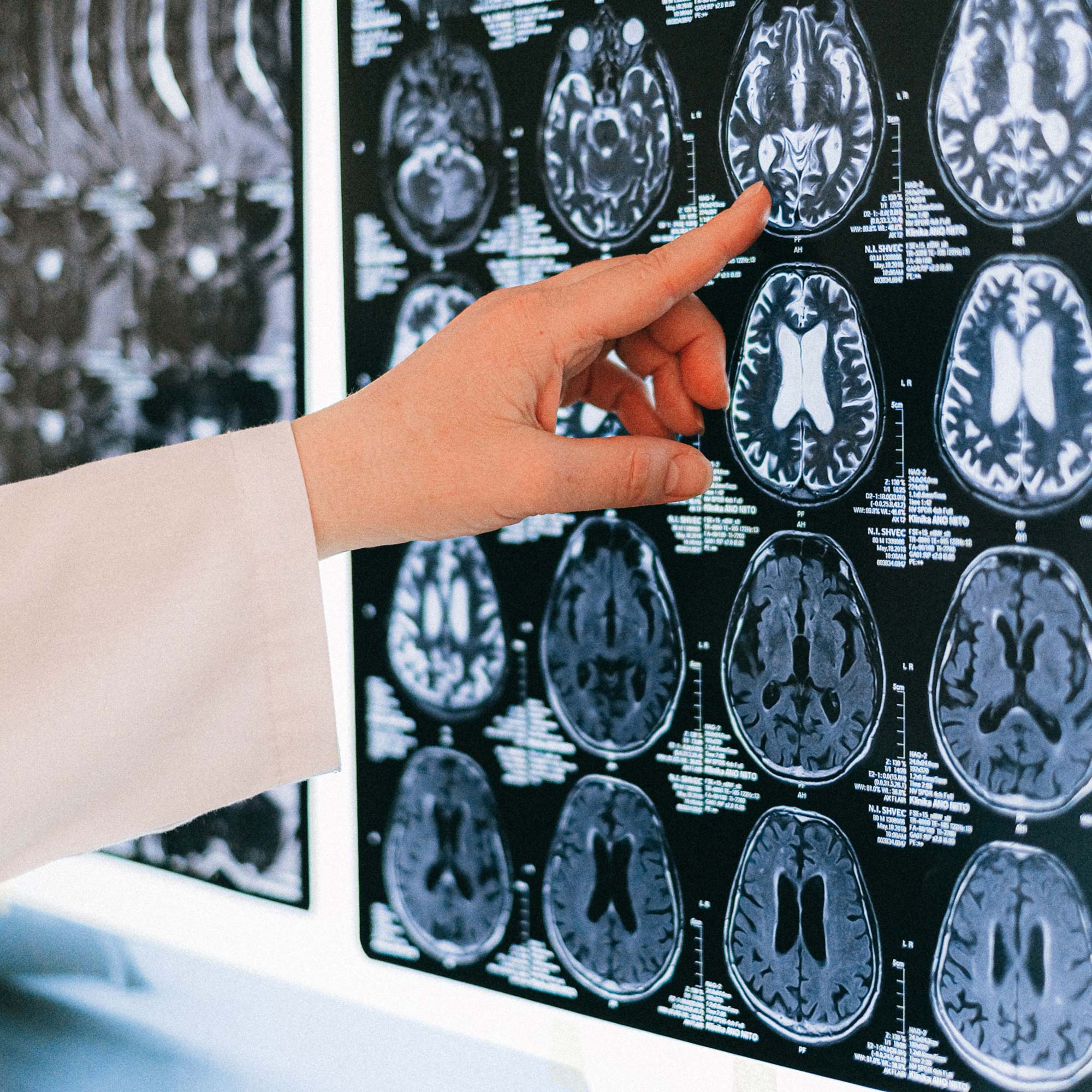 medico neurochirurgo indica e discute risultati di una risonanza